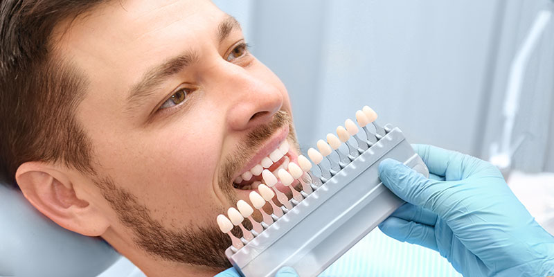 Professionelles Bleaching beim Zahnarzt